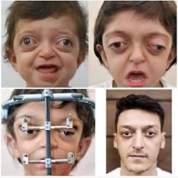Mesut Özil